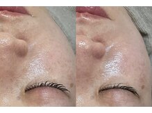 ビーマジック(Be Magic)/毛穴も乾燥も撃退！