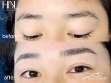 フェリーチェ(Felice)/ハリウッドブロウリフト