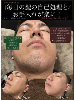 ジョエルワックス 沖縄那覇店(JOELLE WAX)/メンズ髭！毎日の自己処理を楽に