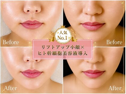 ソウ 新宿(SOU)の写真