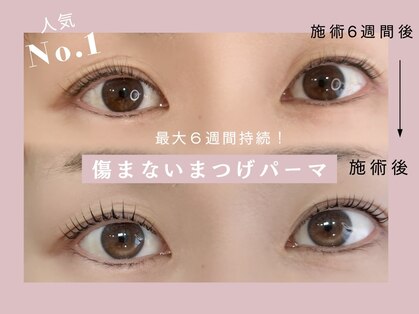 エイム(eim)の写真
