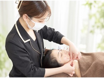 ザヨン(Zayon)の写真/【内側から整える鍼灸】美容鍼・鍼灸・カッピングで美と健康をサポート♪すっきり小顔/DT中のお悩みにも◎