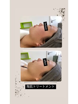 サロンドール(SalonDoll)/リピート率90%以上!!