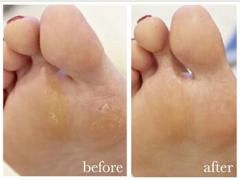 グリーングリーン(GREEN GREEN)/素足美人を目指しましょう♪