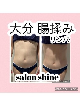 サロンシャイン(Salon Shine)/腸揉みリンパ！スッキリ！４０代