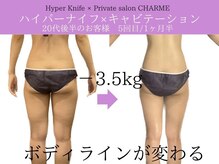 シャルム(charme)/速攻痩せ！ハイパーナイフ痩身