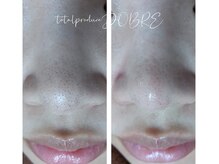 ドブレ(DOBRE)/毛穴洗浄