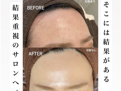 ライチャス(RAICHAS)の写真