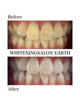 ルーナ 目黒(Luna)/安心の美白ジェル