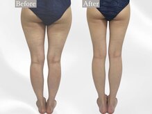 プリマルーチェ/プレミアム下半身プログラム