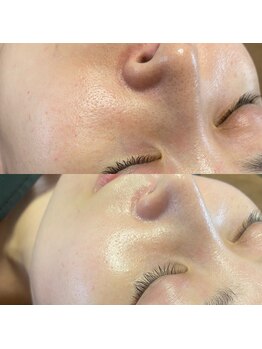 ココフルール(Cocofleur)/バクテリウムピール