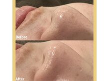プリドー(PULIDO)の雰囲気（【うる艶美肌WAX】鼻の毛穴詰まりが綺麗になりました！）