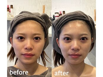 サロンベイア(salon Beia)/タラソトリートメントビフォアフ