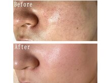 スパ アールアンドビー(SPA*R&B)