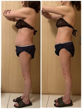 エステサロン エレガンス/