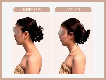 スリムライン 弘前店(The Slim Line)/before→after