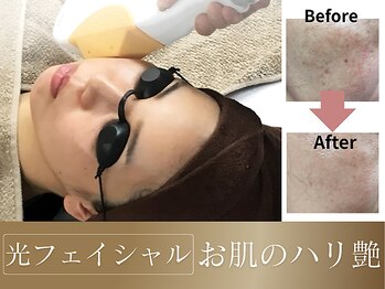 ベル アージュ/感動！光フェイシャル
