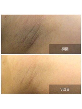 アネル 新都心店(anel)/