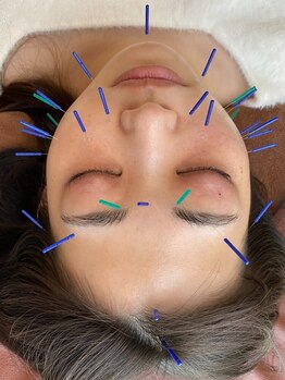 ハリツヤをUPしたい