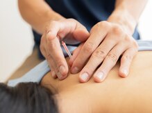 今川鍼灸マッサージ院/【人気No.1メニュー】