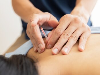 今川鍼灸マッサージ院/【人気No.1メニュー】