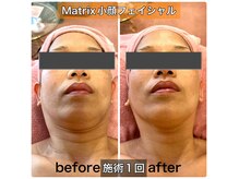 サロンデイジー(Salon Daisy)の雰囲気（国内稀少機種Matrixで 1回でも分かる、引き締め小顔フェイシャル）