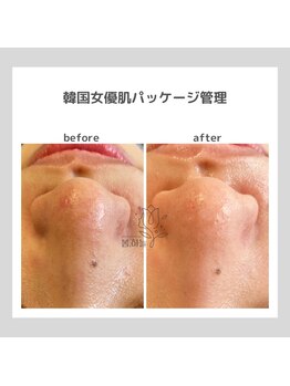 ポムハヌル(pom.haneul)/韓国肌管理室