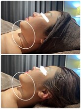 アネル 豊見城(anel)/即実感長期キープ！3D超音波