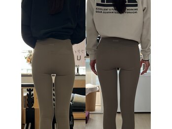 エウレカ(eureka)/ヒップライン改善