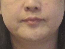 メディケア 新宿/元祖小顔トレーニング