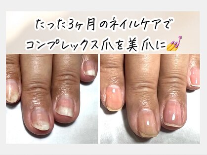カンナ(Kanna)の写真