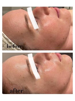 エヌ セレクション(N_selection)/ボンバークリーム×美筋小顔