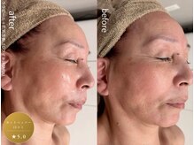 アシュウ(ASHUU)/ビフォーアフター