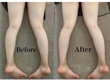 ミセル(MISEL2nd)/キープ力◎リピートNo.1最新痩身