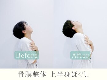 ヒラメント 亀戸院(Hilament)/首こりビフォーアフター〈整体〉