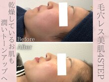 ネオファースト(NeoFirst)