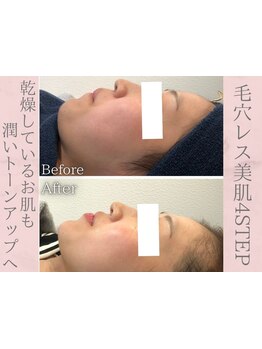 1回ごとにお支払い可能なサロン