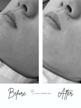 サロン コムモア(salon COMME MOI)/BeforeAfter
