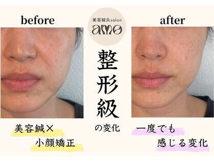 アモ(amo)の写真