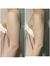 OBS/二の腕ほっそり・ブライダル