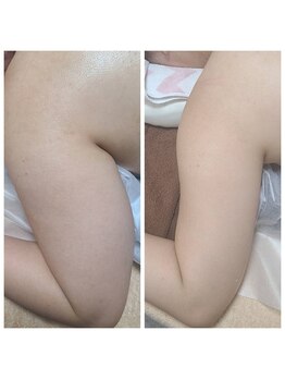 ビハダ(BeHADA)/#圧倒的なサイズダウン