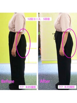 かおりビューティサロン/ヒップアップ2