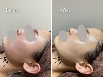 エリー(Ellie)/結婚式前直前1回プラン♪