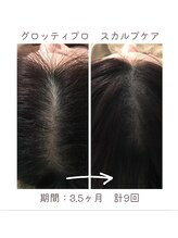 シエルブルー(ciel bleu)/頭皮の環境改善　頭皮、ヘアケア