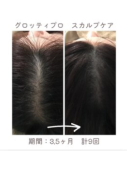 シエルブルー(ciel bleu)/頭皮の環境改善　頭皮、ヘアケア