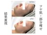 大人気No.1》肌質改善(ララピール)x脂肪分解剤(レモンボトル)艶肌＆小顔へ◎