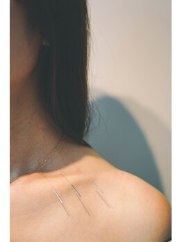 ハウ(How)/image ［岡山 整体 美容鍼］