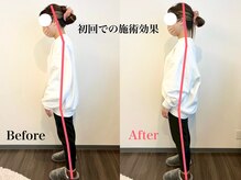 整体 寿 横浜院(KOTOBUKI)/横浜/横浜市/整体/肩こり