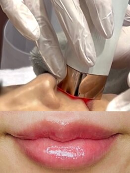 美白ケアをしたい