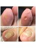 お悩み相談トータルフットケア☆90分11000~